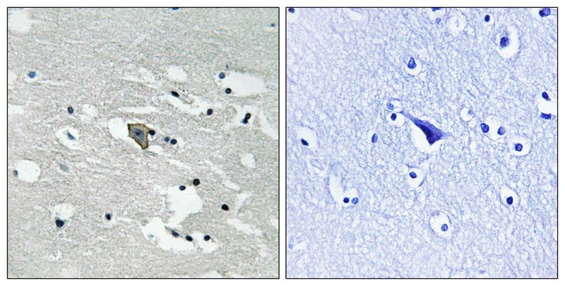 VEGFR1 (Phospho-Tyr1048) Antibody