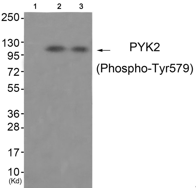 PYK2 (Phospho-Tyr579) Antibody