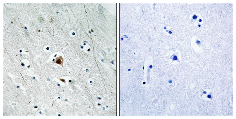 MAPKAPK2 (Phospho-Ser272) Antibody