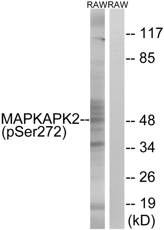 MAPKAPK2 (Phospho-Ser272) Antibody