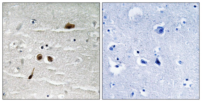 MDC1 (Phospho-Ser513) Antibody