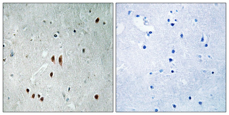 CNOT2 (Phospho-Ser101) Antibody