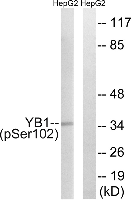 YB1 (Phospho-Ser102) Antibody