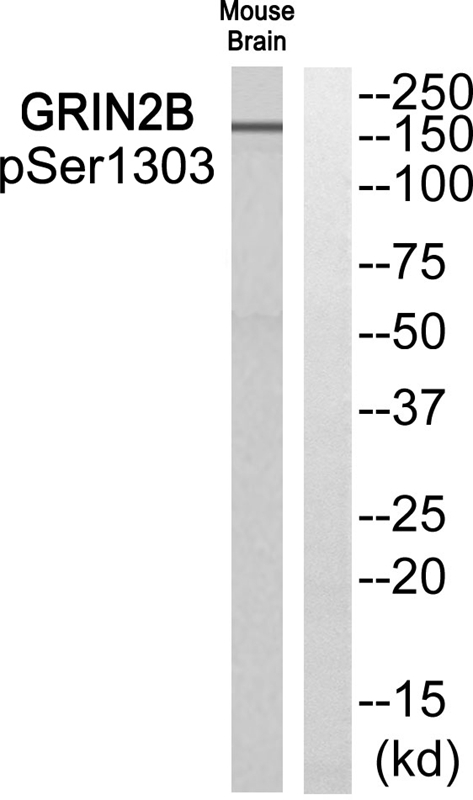 GRIN2B (Phospho-Ser1303) Antibody