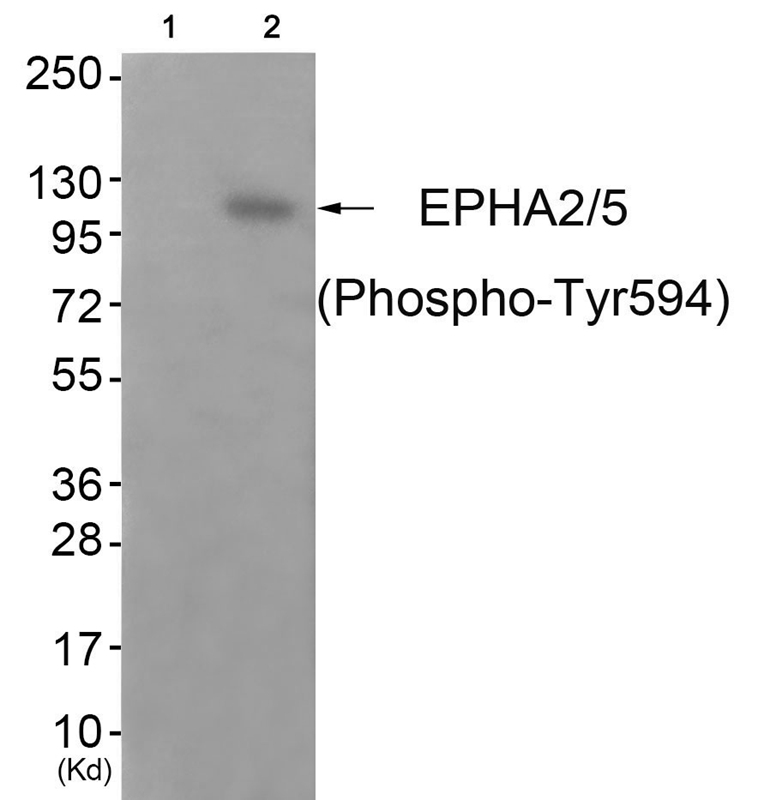 EPHA2/5 (Phospho-Tyr594) Antibody