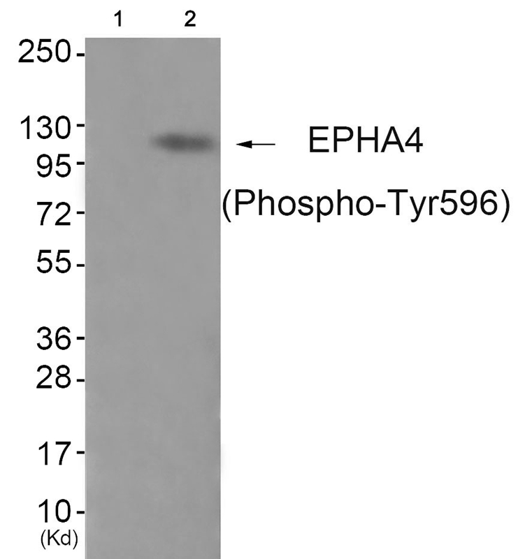 EPHA4 (Phospho-Tyr596) Antibody