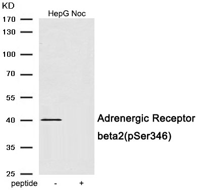 Adrenergic Receptor beta2 (Phospho-Ser346) Antibody