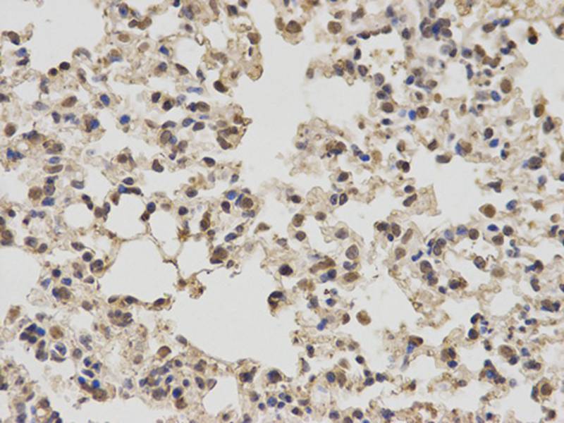 PKM2 Antibody