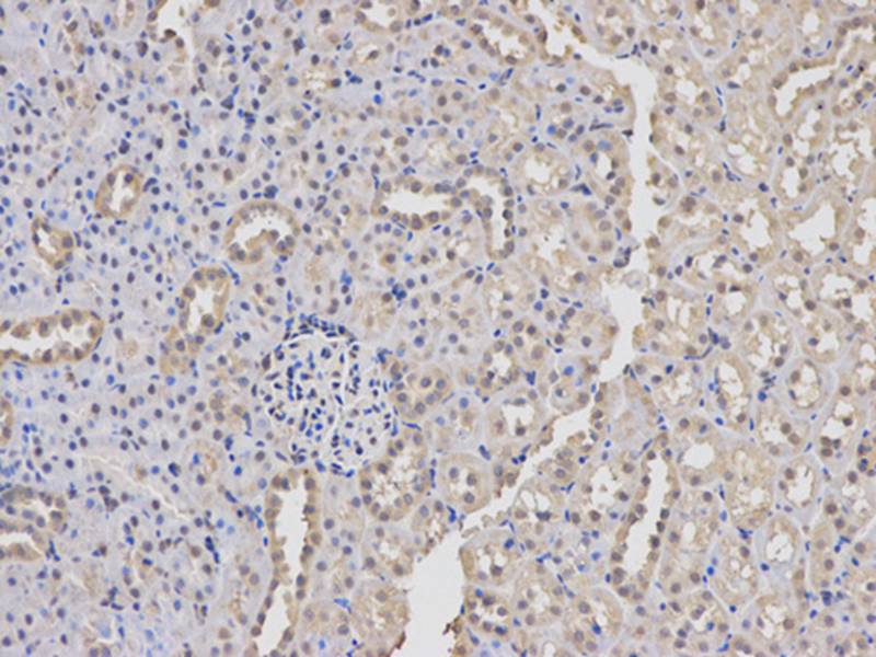 PKM2 Antibody