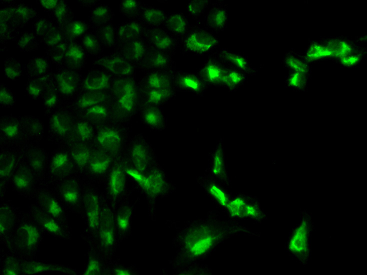 FCGR1A Antibody - SAB | Signalway Antibody