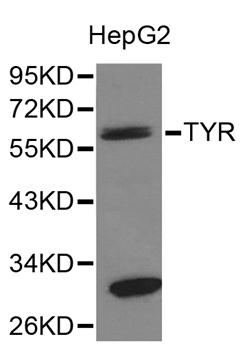 TYR Antibody