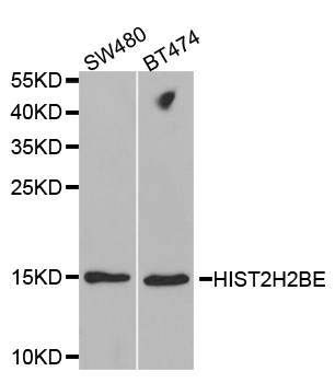 HIST2H2BE Antibody