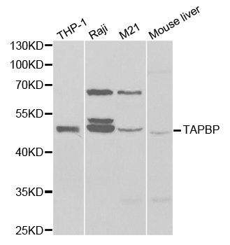 TAPBP Antibody