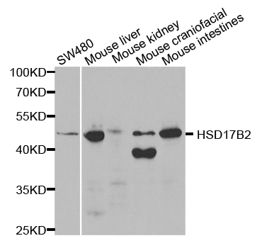 HSD17B2 Antibody