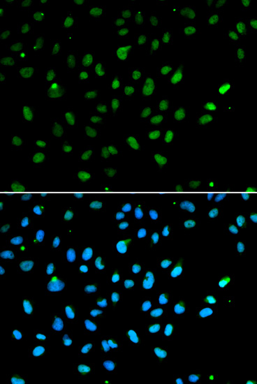 SMARCA4 Antibody