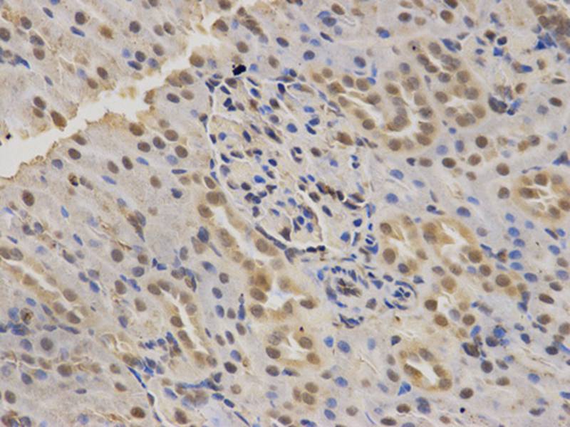 SMARCA4 Antibody