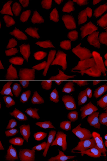 PSMC4 Antibody