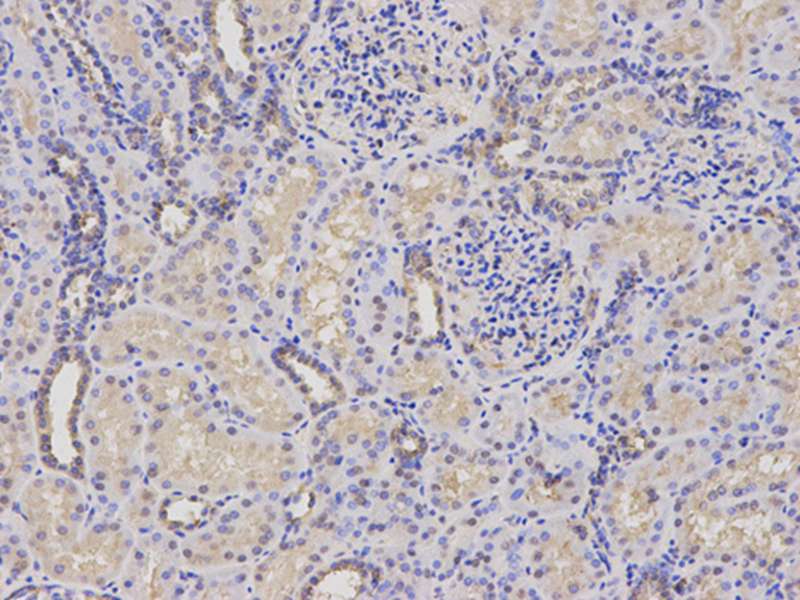 PSMC4 Antibody