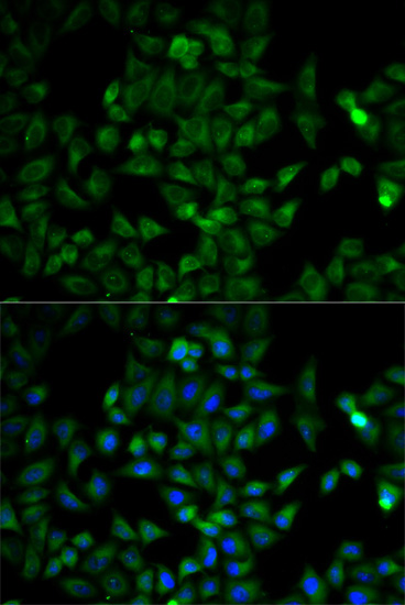 TPI1 Antibody