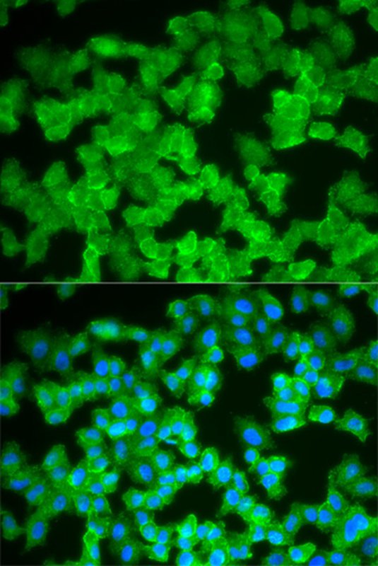 S100A12 Antibody