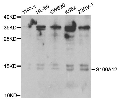 S100A12 Antibody