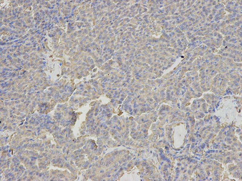 ANXA6 Antibody