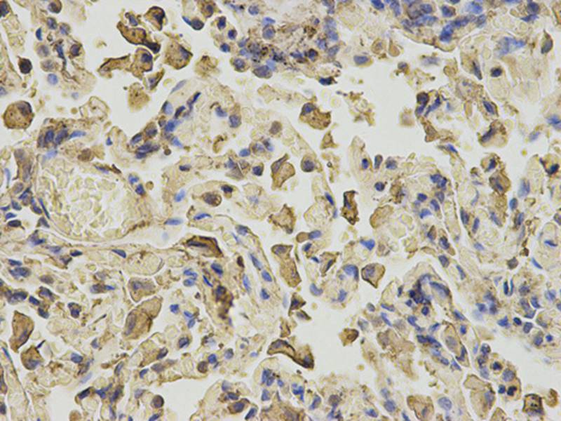 ANXA6 Antibody