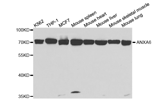 ANXA6 Antibody