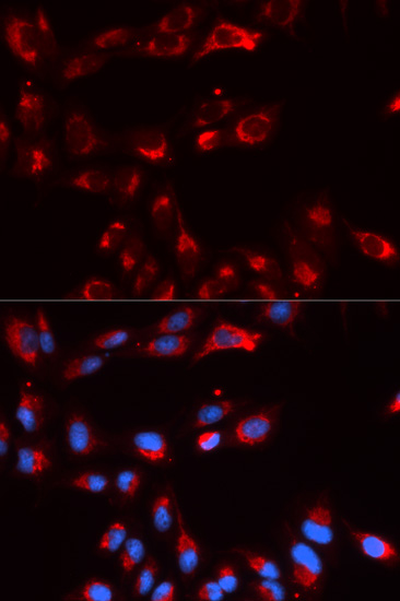 CFP Antibody