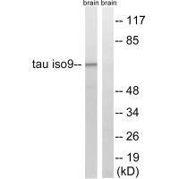 Tau (Ab-534/217) Antibody