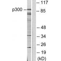 P300/CBP Antibody