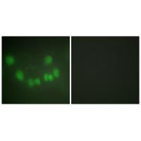 CDC2 Antibody