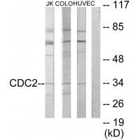 CDC2 Antibody