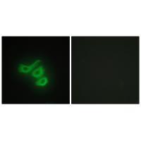 M-CK Antibody 