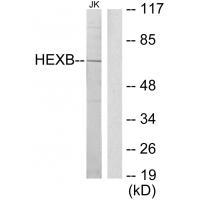 HEXB Antibody 