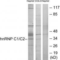 hnRNP C1/C2 Antibody