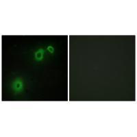 TNR16 Antibody 