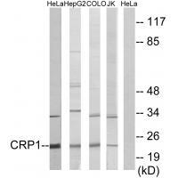 CRP1 Antibody