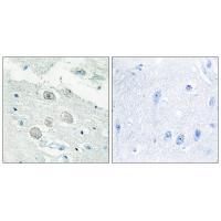 JAK1 Antibody