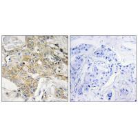 T4S1 Antibody