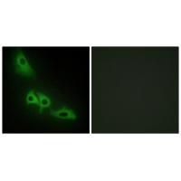 GLPK Antibody 