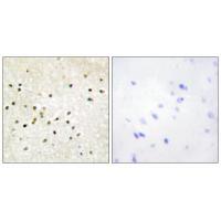 TF2H1 Antibody