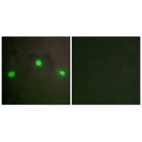 ATRX Antibody