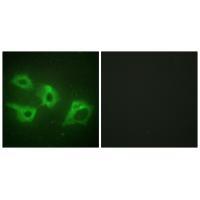 CKI-α Antibody