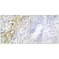 CKI-α Antibody