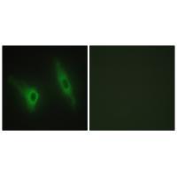 CKI-ε Antibody 