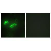 TFAM Antibody