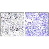 TEAD2 Antibody