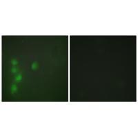 ZNF174 Antibody