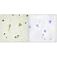 TSC22D1 Antibody